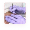 Facial dan Peeling Jerawat