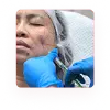 Bopeng dan Scar Atrofik