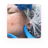 Collagen Stimulator