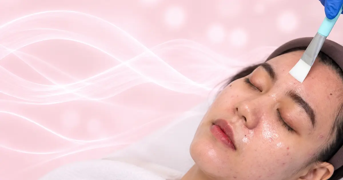 Treatment Jerawat & Perawatan Kulit
