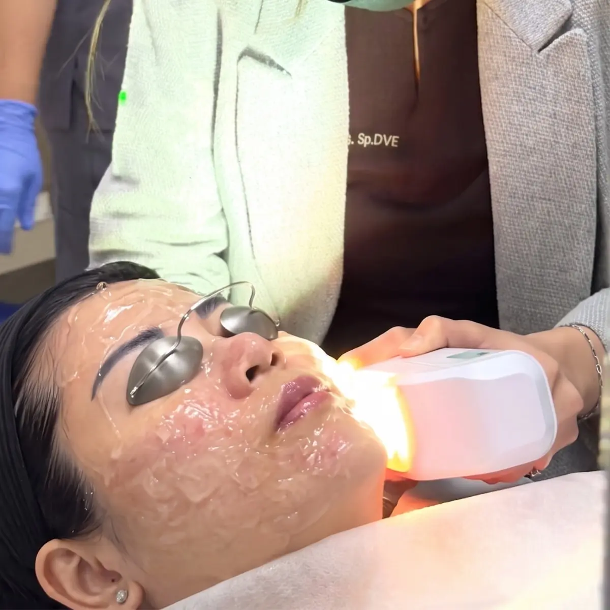 Red-away Photofacial