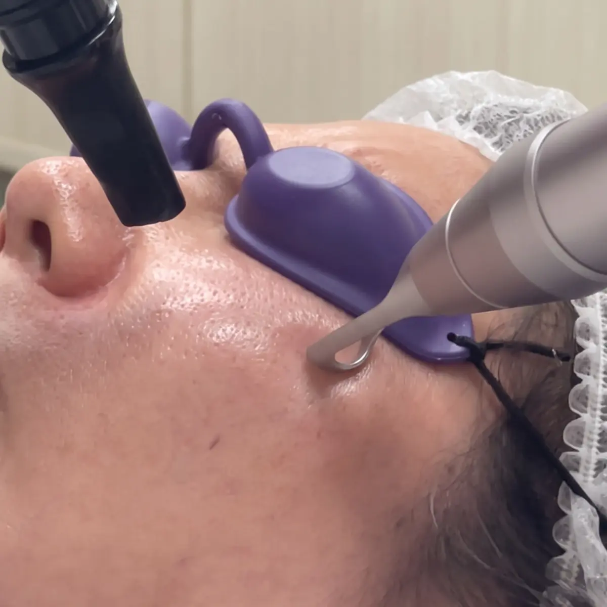 Crystal Glow Laser Toning