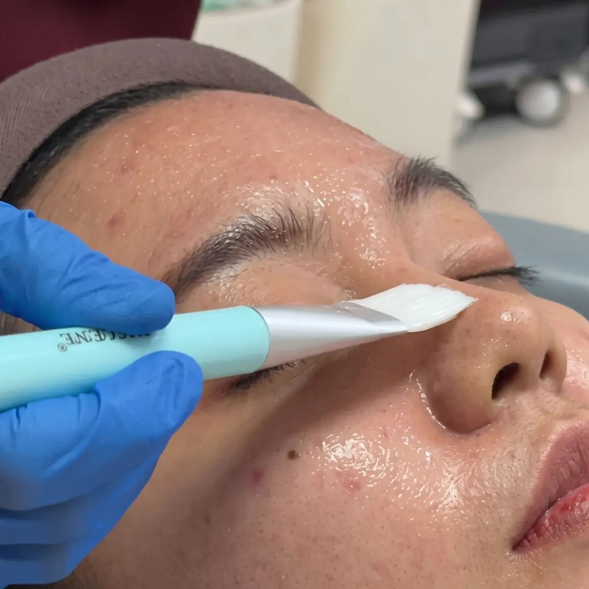 Brightening Glow Peel